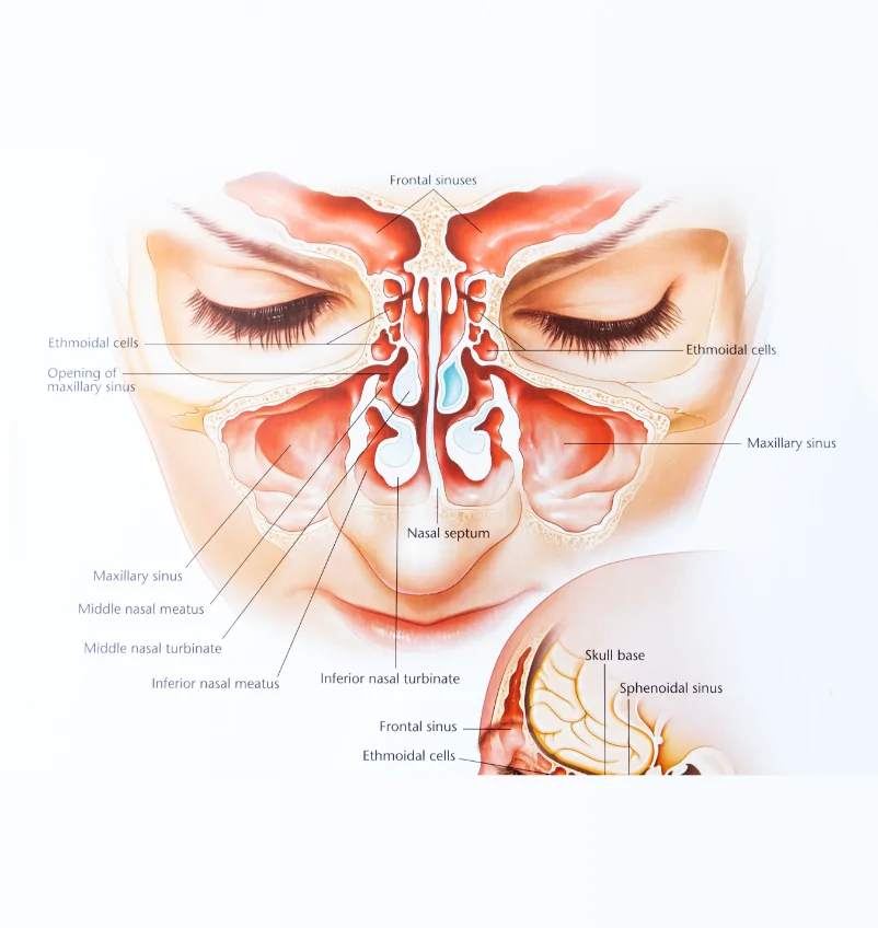 Sinus (Sinusitis) Specialist Doctor Sydney Dr Crawford