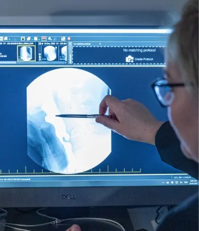 Non Cancerous Salivary Gland | Dr Julia Crawford